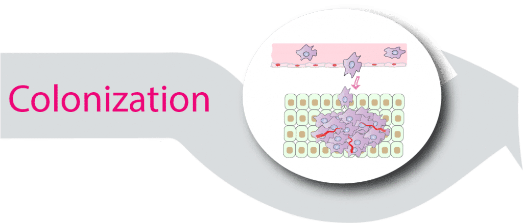 Demystifying Metastatic Breast Cancer