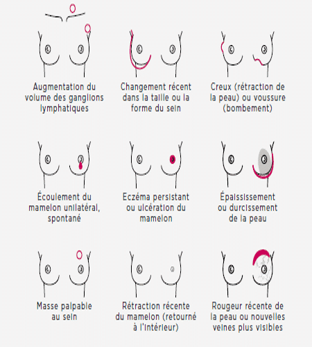 Prenez la santé de vos seins en mains !
