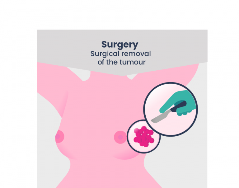 Surgery